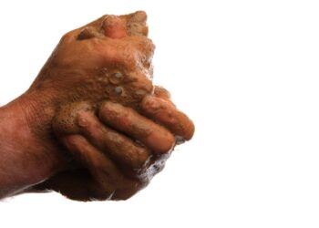 Gli utensili di igiene